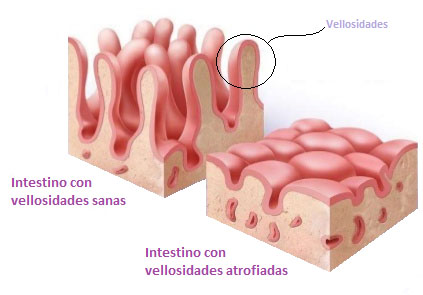 Vellosidades del intestino